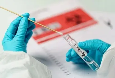 Laboratório do HSI realiza teste rápido antígeno de Covid com resultado em até quatro horas 