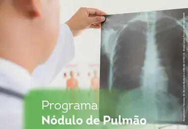Projeto Nódulo Pulmonar Hospital Santa Izabel