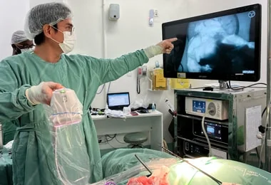 Hospital Santa Izabel registra novo pioneirismo em procedimento cirúrgico na Bahia